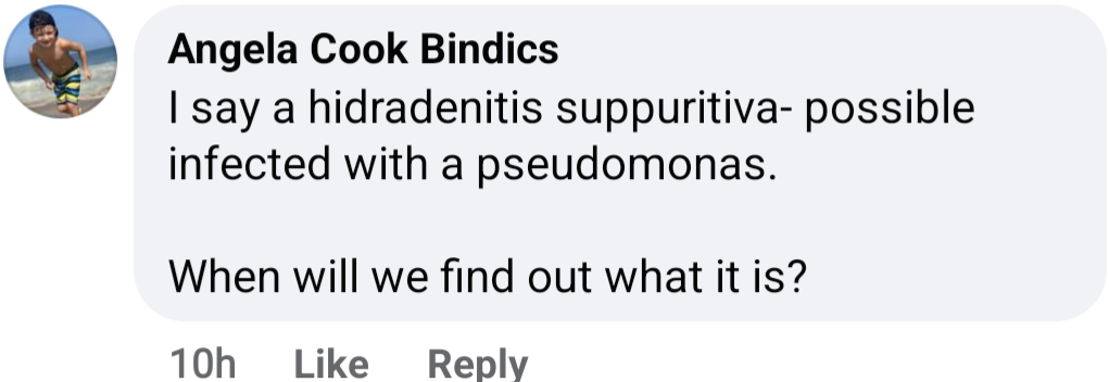 Idiot NP can't make the diagnosis when it's staring her in the face