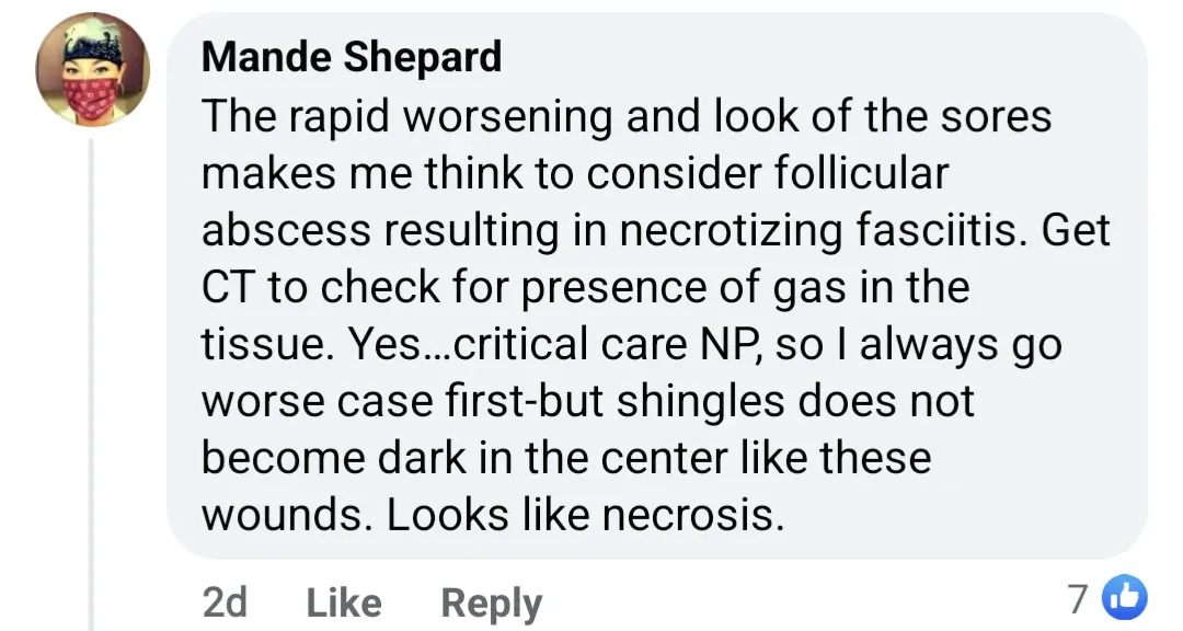 Idiot NP can't make the diagnosis when it's staring her in the face