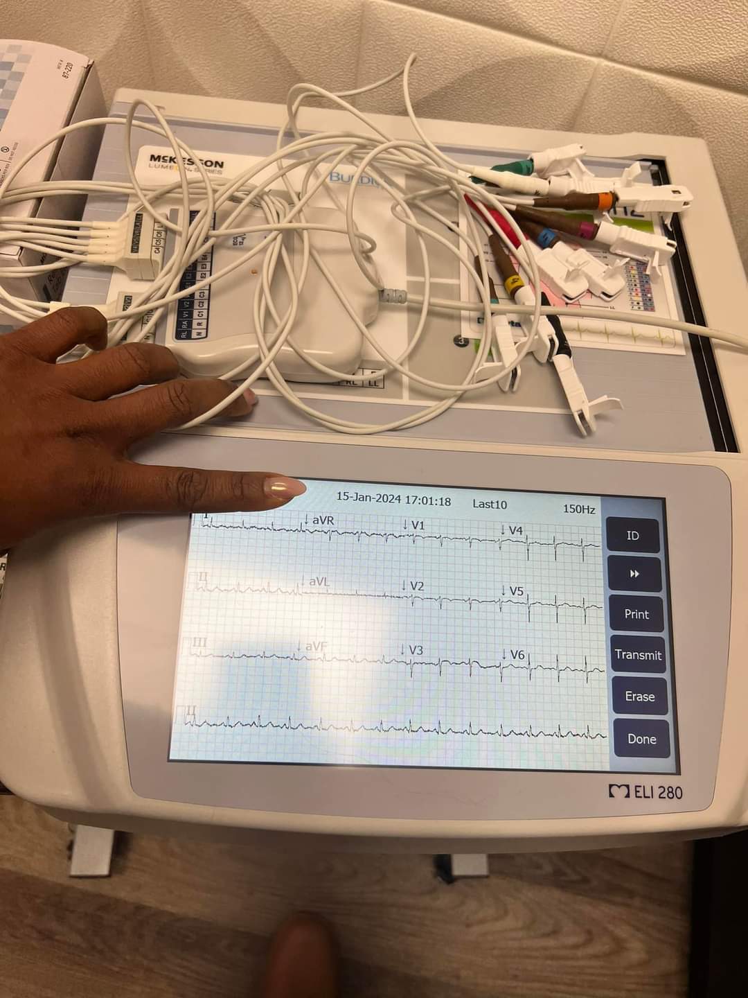 Elite NP has great faith in her new EKG machine's ability to interpret EKGs