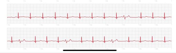 Clueless NP can't read her patient's EKG, so she posts it on Facebook